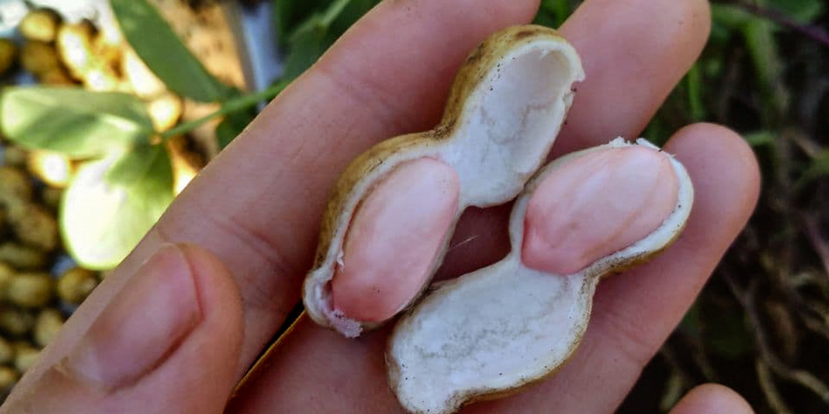 Обычный арахис едва не погубил 54-летнего жителя Туапсе, засорив пищевод